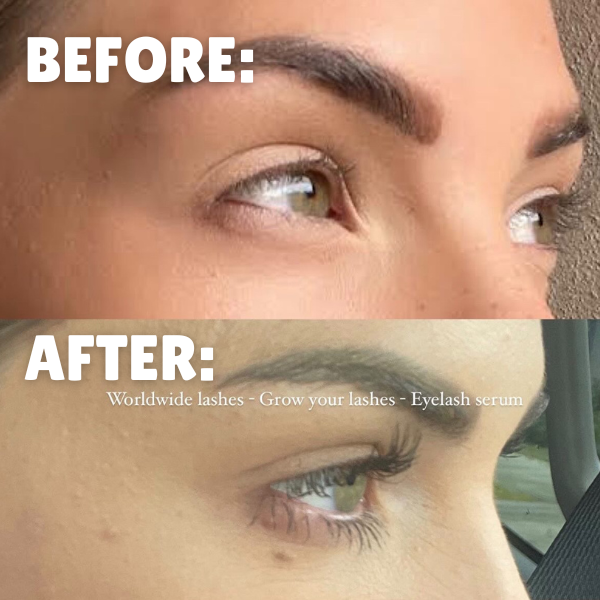 Grow your lashes - Eyelash serum