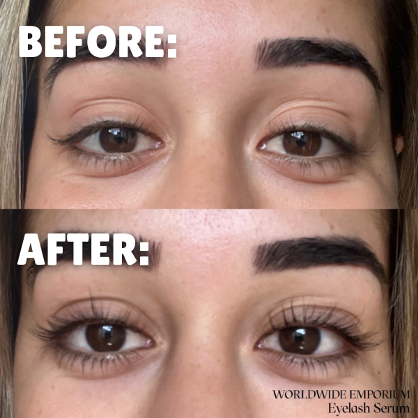 Grow your lashes - Eyelash serum